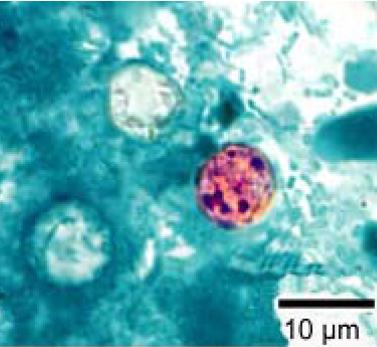 Cyclospora cayetanensis stained